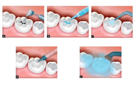Dentista en Jaén - Clínica Dental en Jaén - Espacio Dental Jaén